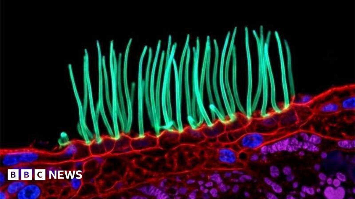 A frame from the disqualified video showing long green cilia waving from a red surface