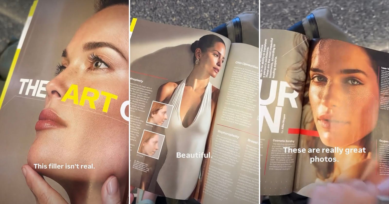 Image for Beauty magazine illustrates a cosmetic-surgery story with AI women, prompts left in