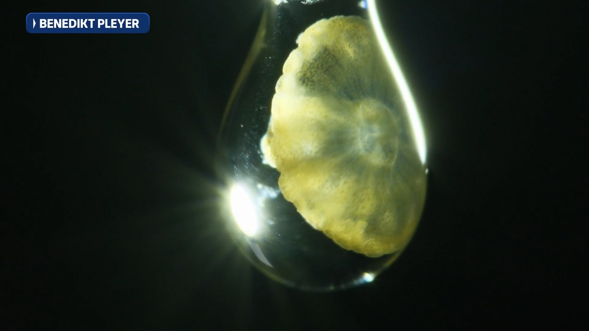 Jellyfish larvae in water droplets, magnified 25 times, which took third place in the 2026 contest